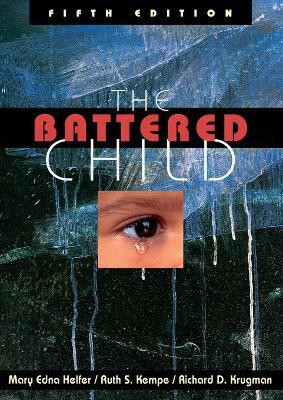 The Battered Child(English, Paperback, unknown)