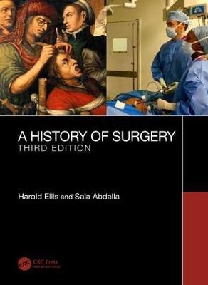 A History of Surgery(English, Paperback, Ellis Harold)