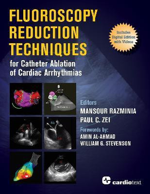 Fluoroscopy Reduction Techniques for Catheter Ablation of Cardiac Arrhythmias(English, Paperback, unknown)