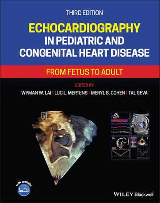 Echocardiography in Pediatric and Congenital Heart Disease(English, Hardcover, unknown)