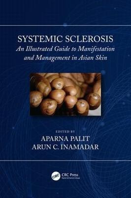 Systemic Sclerosis(English, Electronic book text, unknown)