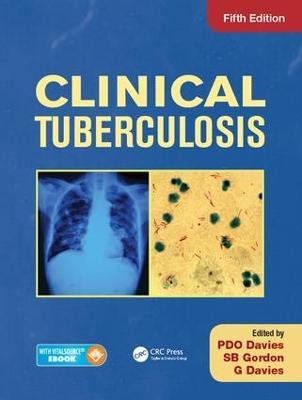 Clinical Tuberculosis(English, Electronic book text, unknown)