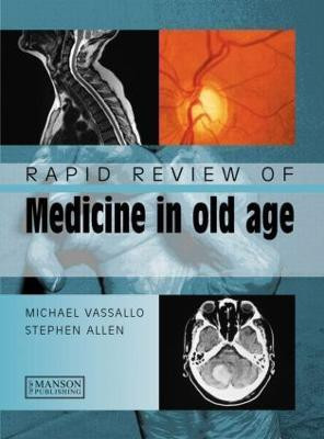 Rapid Review of Medicine in Old Age(English, Paperback, Vassallo Michael)