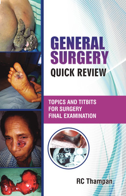 GENERAL SURGERY QUICK REVIEW  - Topics and titbits for the surgery final examination(Paperback, Thampan R C)