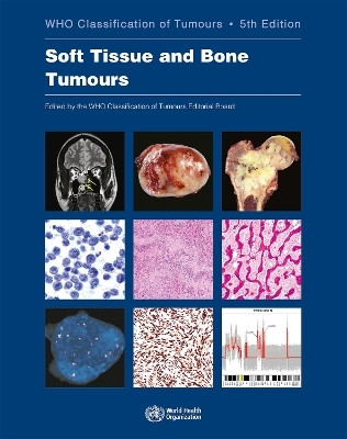 WHO classification of tumours of soft tissue and bone tumours(English, Paperback, International Agency for Research on Cancer)