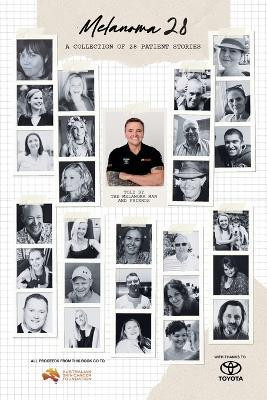 Melanoma 28(English, Paperback, unknown)