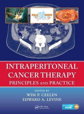 Intraperitoneal Cancer Therapy(English, Hardcover, unknown)