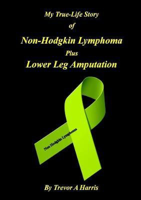 My True-Life Story of Non-Hodgkin Lymphoma Plus Amputation(English, Paperback, Harris Trevor A)