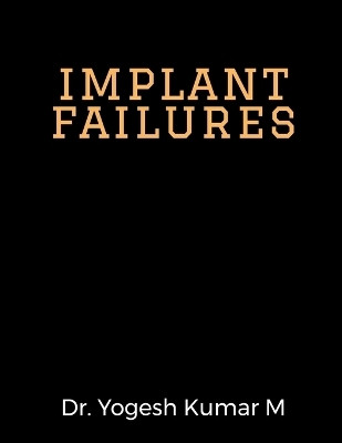 implant failures(English, Paperback, Dr Yogesh Kumar M)