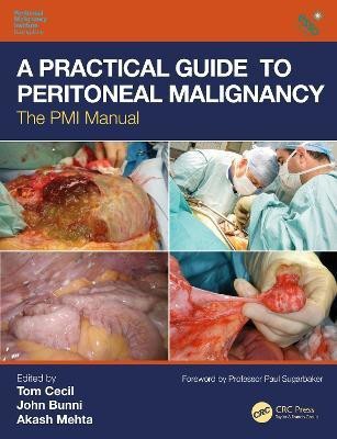 A Practical Guide to Peritoneal Malignancy(English, Paperback, unknown)