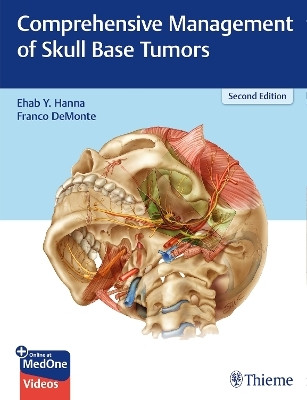 Comprehensive Management of Skull Base Tumors(English, Electronic book text, Hanna Ehab Y.)