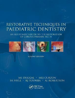 Restorative Techniques in Paediatric Dentistry(English, Electronic book text, Duggal M.S.)