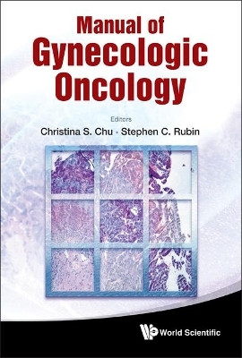 Manual Of Gynecologic Oncology(English, Hardcover, unknown)