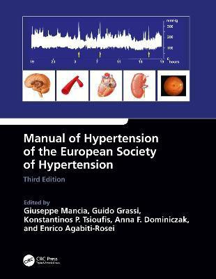 Manual of Hypertension of the European Society of Hypertension, Third Edition(English, Paperback, unknown)