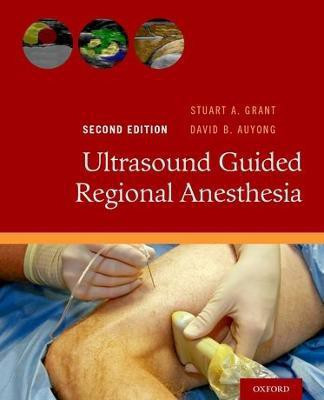 Ultrasound Guided Regional Anesthesia(English, Paperback, unknown)