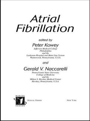 Atrial Fibrillation(English, Hardcover, unknown)