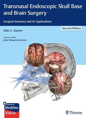 Transnasal Endoscopic Skull Base and Brain Surgery(English, Mixed media product, unknown)