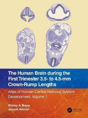 The Human Brain during the First Trimester 3.5- to 4.5-mm Crown-Rump Lengths(English, Paperback, Bayer Shirley A.)