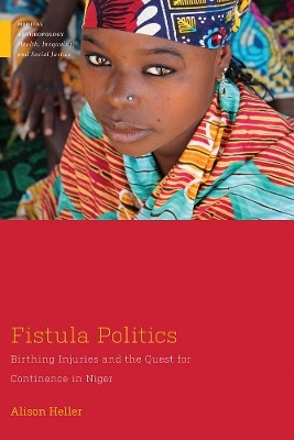 Fistula Politics(English, Electronic book text, Heller Alison)