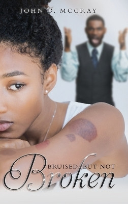 Bruised but not Broken(English, Hardcover, John D McCray)