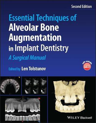 Essential Techniques of Alveolar Bone Augmentation in Implant Dentistry(English, Hardcover, unknown)