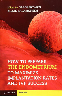 How to Prepare the Endometrium to Maximize Implantation Rates and IVF Success(English, Electronic book text, unknown)