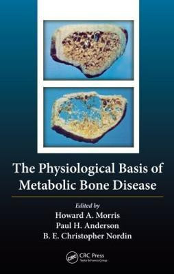 The Physiological Basis of Metabolic Bone Disease(English, Hardcover, unknown)