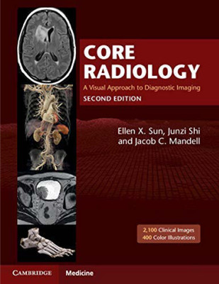 Core Radiology: A Visual Approach To Diagnostic Imaging 2nd Edition(Paperback, Ellen X. Sun, Junzi Shi, Jacob C. Mandell)