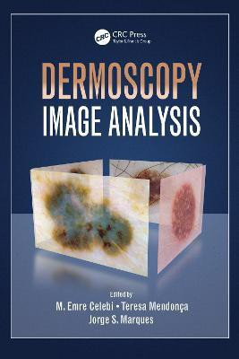 Dermoscopy Image Analysis(English, Electronic book text, unknown)