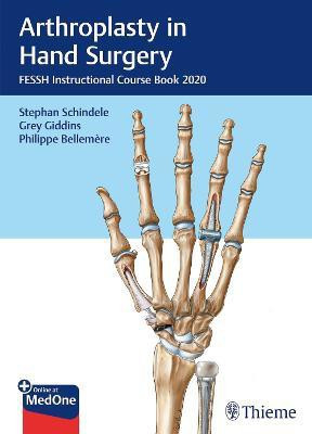Arthroplasty in Hand Surgery(English, Mixed media product, unknown)