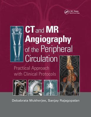 CT and MR Angiography of the Peripheral Circulation(English, Paperback, unknown)