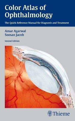Color Atlas of Ophthalmology 2nd Edition(English, Paperback, unknown)