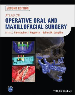 Atlas of Operative Oral and Maxillofacial Surgery(English, Hardcover, unknown)