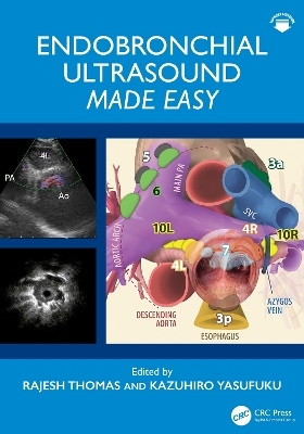 Endobronchial Ultrasound Made Easy(English, Paperback, unknown)