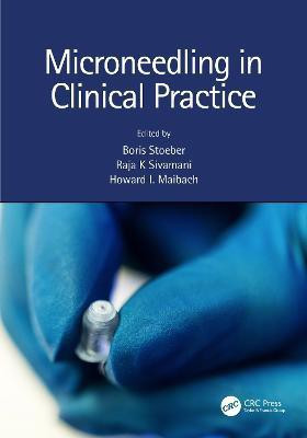 Microneedling in Clinical Practice(English, Paperback, unknown)