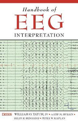 Handbook of EEG Interpretation(English, Paperback, Tatum William)