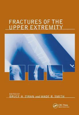 Fractures of the Upper Extremity(English, Paperback, unknown)