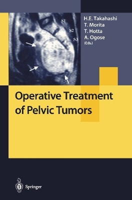 Operative Treatment of Pelvic Tumors(English, Paperback, unknown)