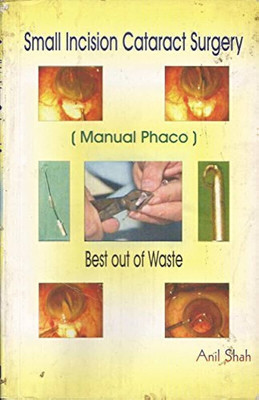 SMALL INCISION CATARACT SURGERY WITH CD  - Manual Phaco(Paperback, ANIL SHAH)