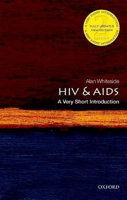 HIV & AIDS(English, Paperback, Whiteside Alan)