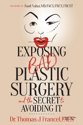 Exposing Bad Plastic Surgery(English, Paperback, Francel Thomas J. Dr. FACS)