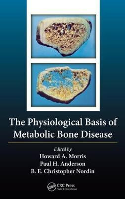The Physiological Basis of Metabolic Bone Disease(English, Electronic book text, unknown)