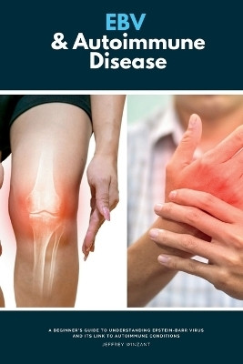 EBV & Autoimmune Disease(English, Paperback, Winzant Jeffrey)
