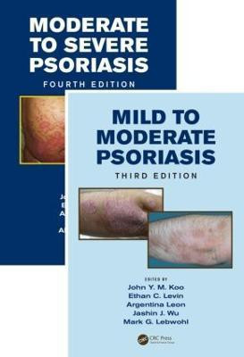 Mild to Moderate and Moderate to Severe Psoriasis (Set)(English, Book, unknown)