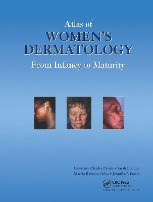 Atlas of Women's Dermatology(English, Hardcover, Parish MD Lawrence Charles)
