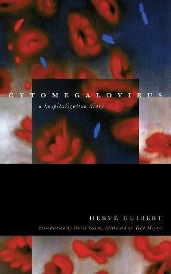 Cytomegalovirus(English, Paperback, Guibert Herve)