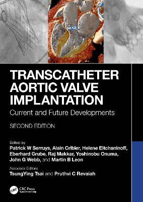 Transcatheter Aortic Valve Implantation(English, Hardcover, unknown)