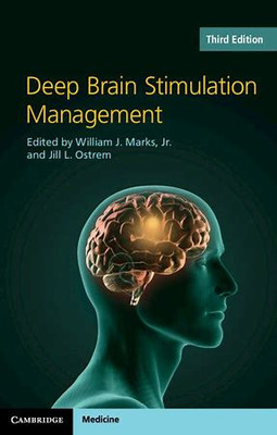 Deep Brain Stimulation Management(English, Electronic book text, unknown)