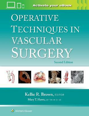 Operative Techniques in Vascular Surgery(English, Hardcover, unknown)