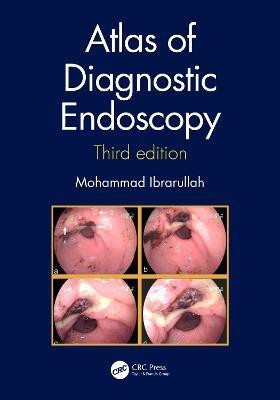 Atlas of Diagnostic Endoscopy, 3E(English, Hardcover, Ibrarullah Mohammad)